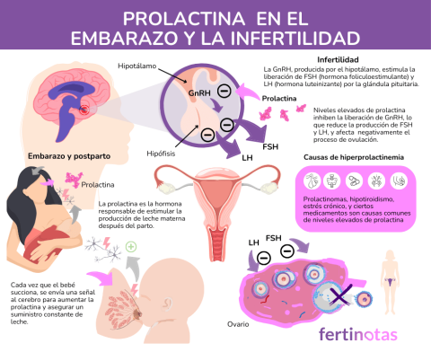 Prolactina alta y fertilidad femenina: Causas y tratamientos