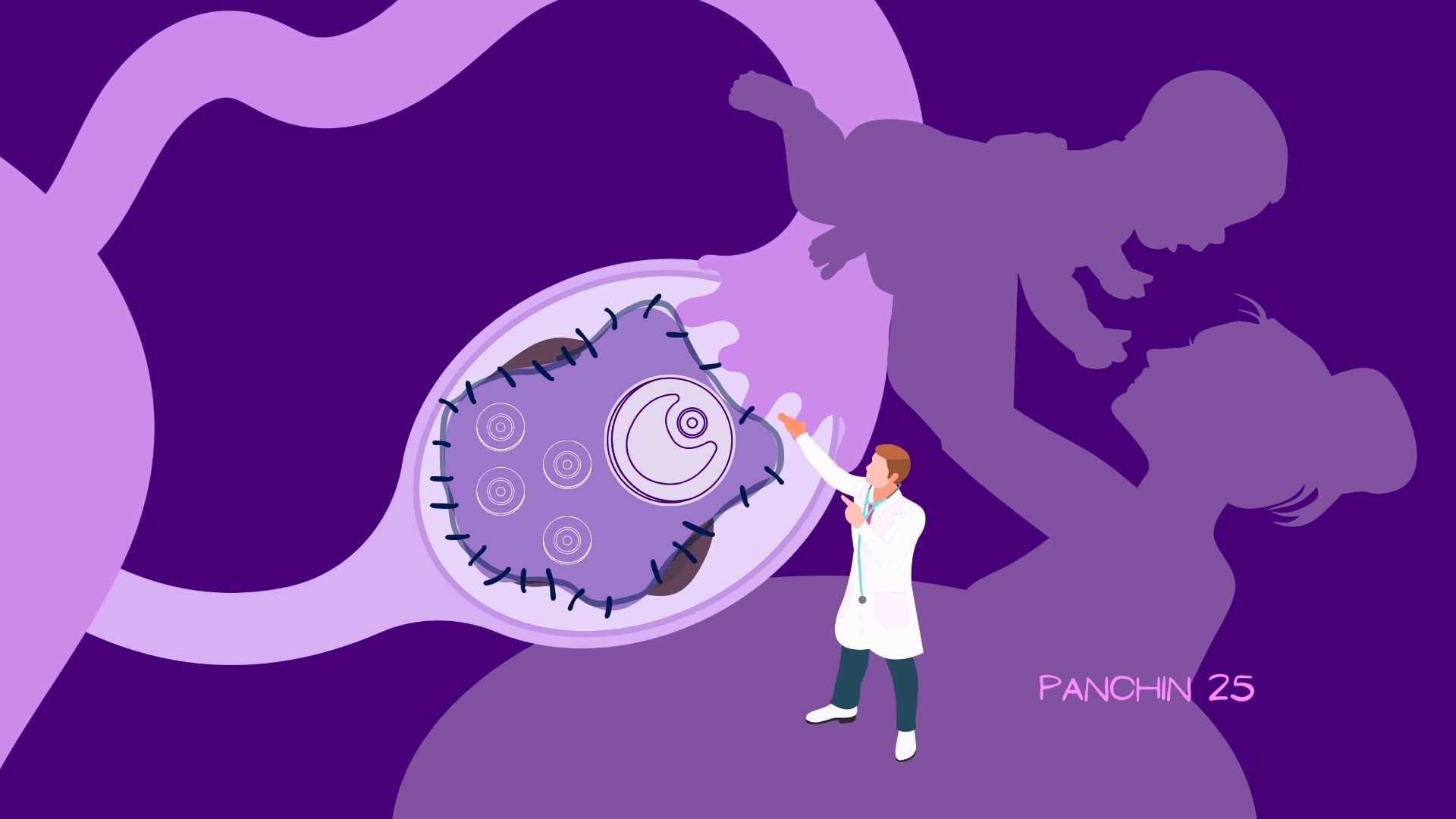 Trasplante tejido ovarico sindrome de Turner Ilustración muestra trasplante de tejido ovárico medico explicando y madre cargando su bebé