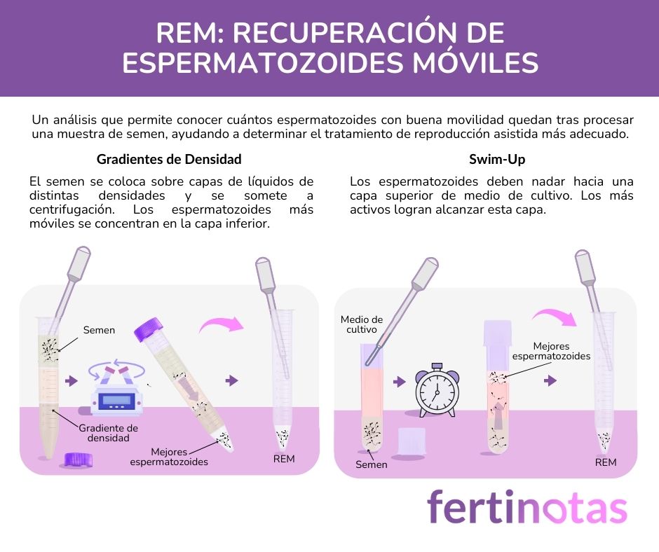 Seminograma REM Seminograma REM