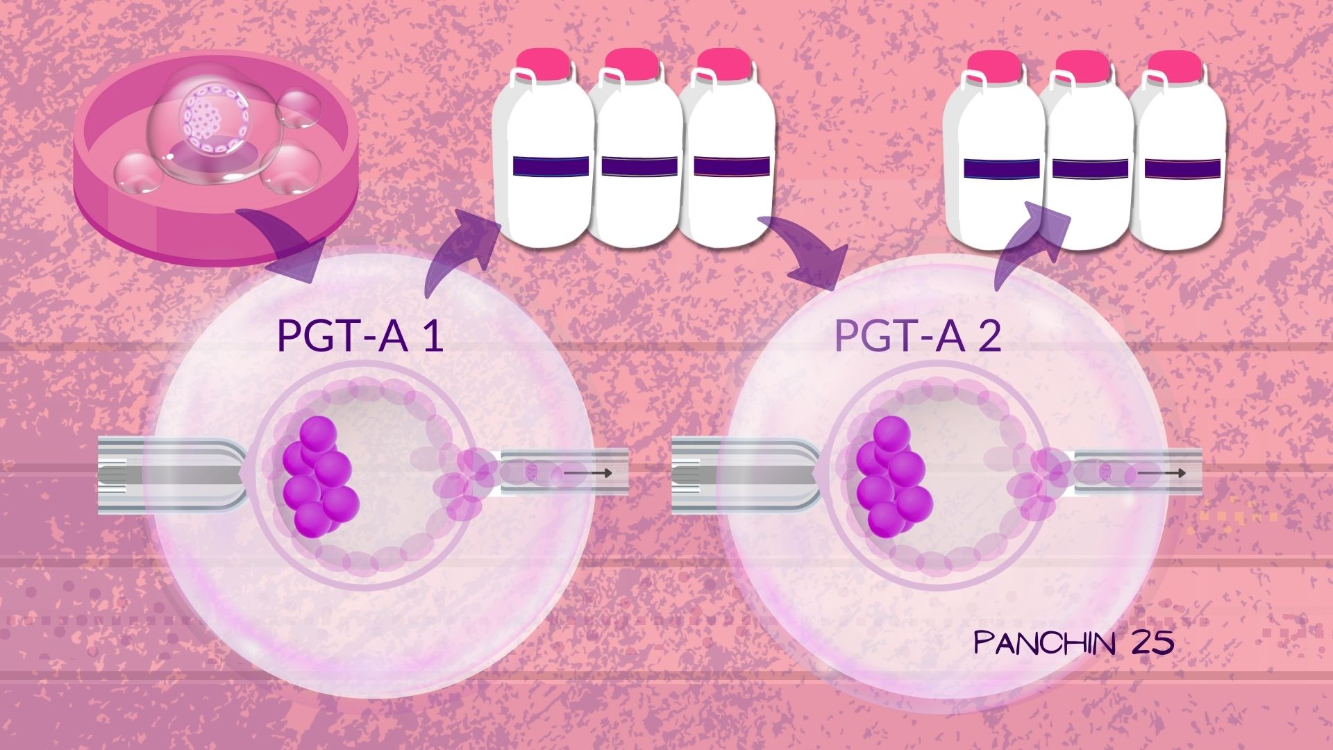 PGTA no concluyente doble biopsia Hacer doble biopsia de embrión en caso de PGTA no concluyente