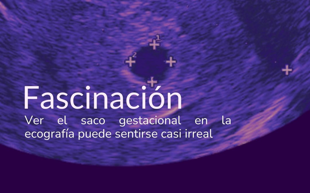 Fascinación al ver la primera ecografía del embarazo