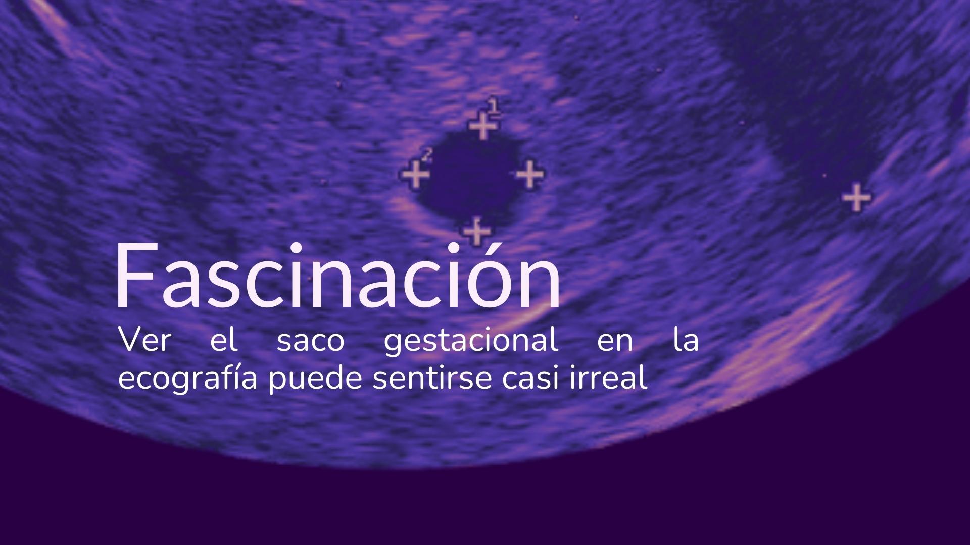 Primera ecografía embarazo emociones fascinacion