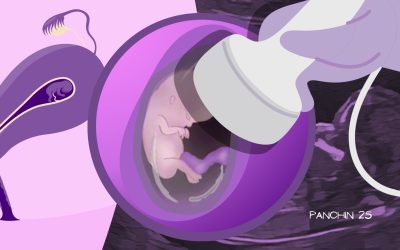 Tu bebé en la semana 12 de embarazo