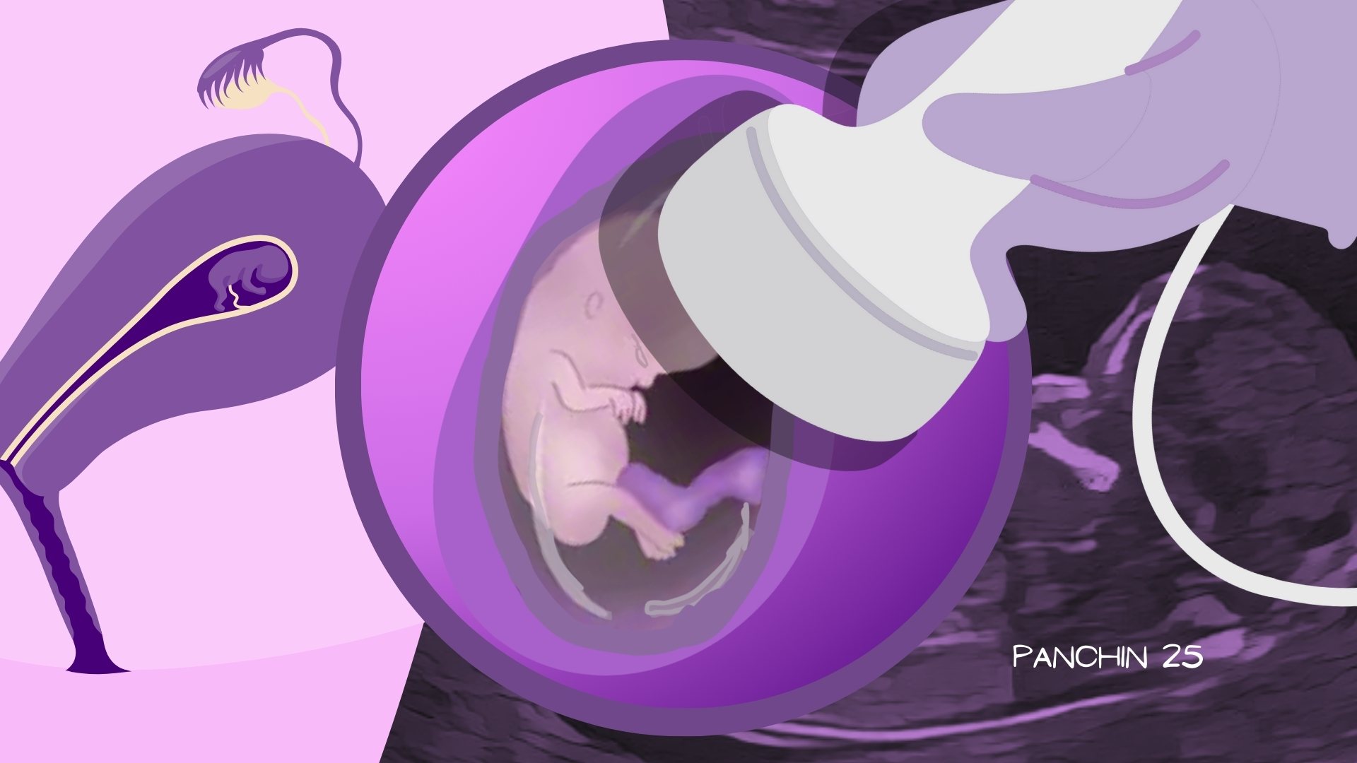 semana 12 embarazo bebe Bebé en semana 12 embarazo