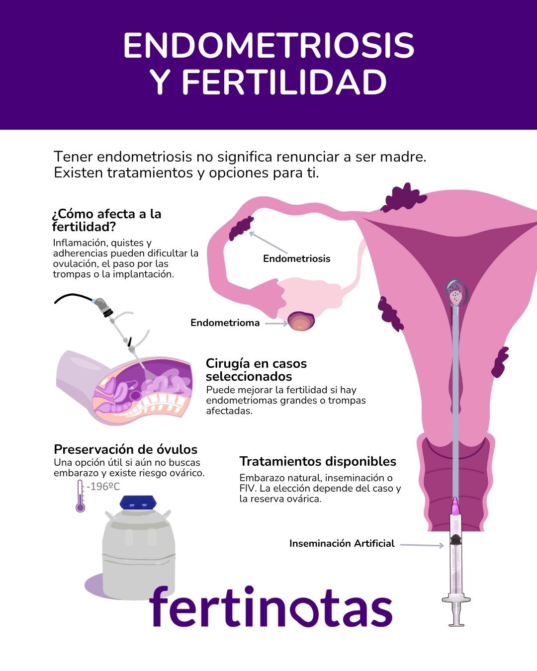 Cómo afecta la endometriosis la fertilidad Infografía sobre endometriosis y fertilidad: cómo afecta, tratamientos posibles y preservación de óvulos