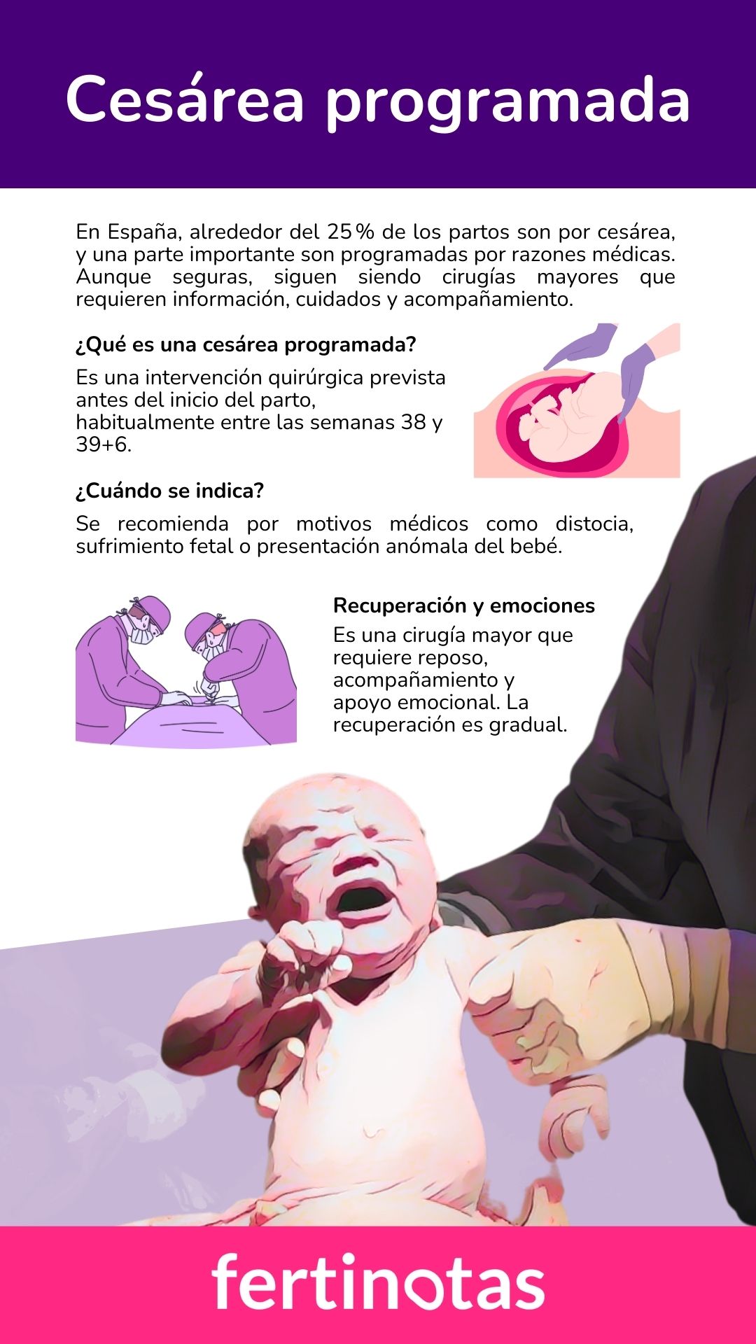 cesárea programada (1) Infografía sobre cuándo se indica una cesárea programada, cómo se realiza y cómo es la recuperación