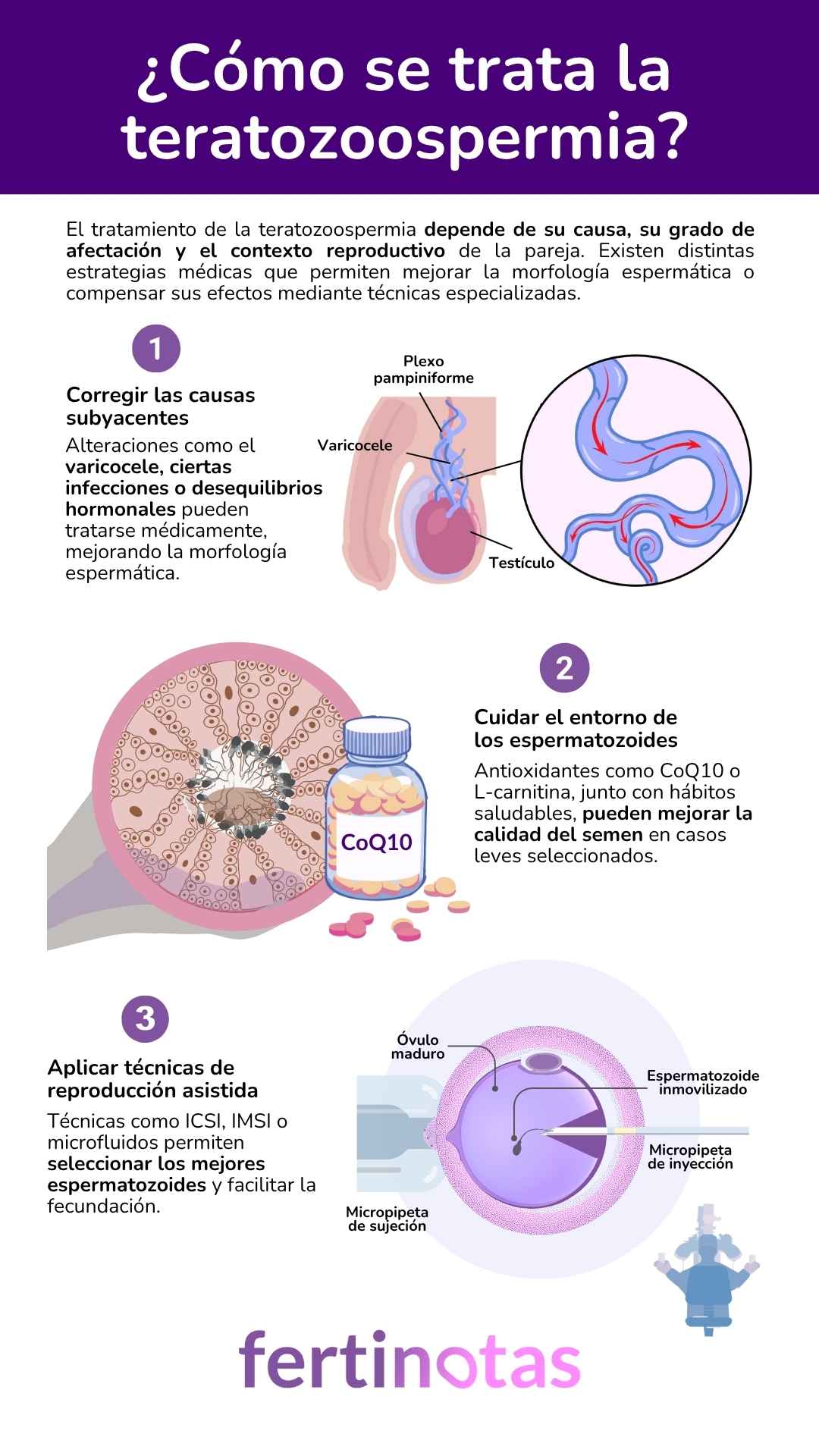 Infografía con tratamientos para la teratozoospermia: cirugía de varicocele, suplementos antioxidantes y técnicas de reproducción asistida.