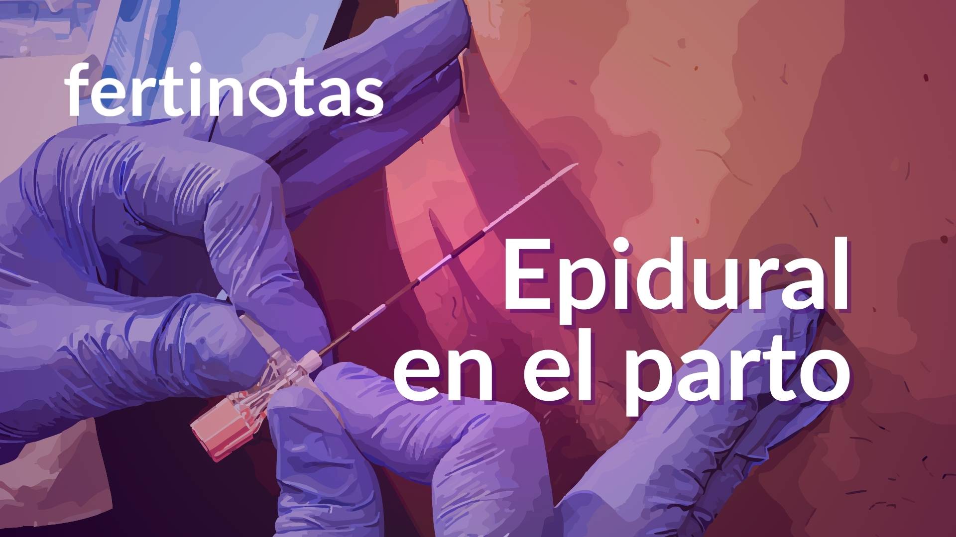 epidural en el parto ventajas y desventajas Anestesista administrando anestesia epidural a una mujer embarazada durante el parto</p>
<p>