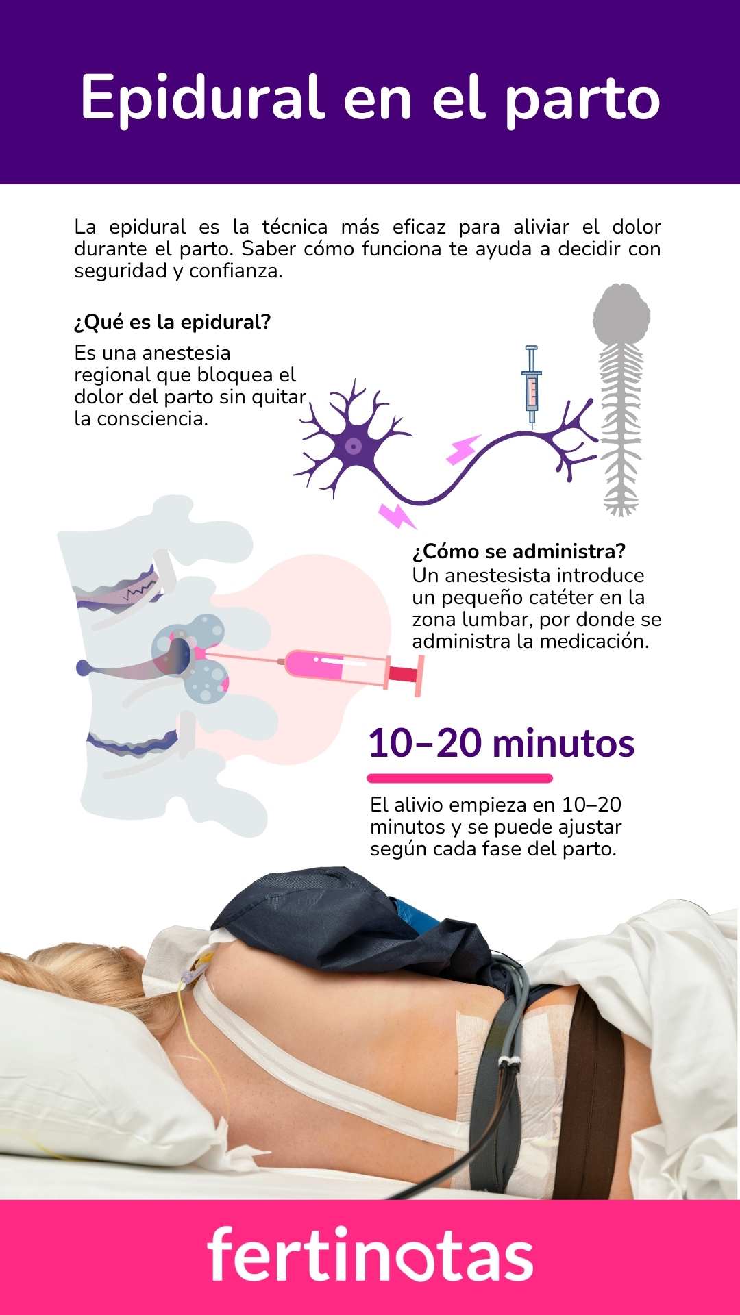 epidural en el parto Infografía explicativa sobre qué es la epidural, cómo se aplica, cuándo hace efecto, sus beneficios y riesgos