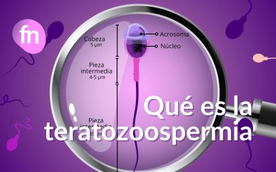 Teratozoospermia: qué es, causas, diagnóstico y opciones de tratamiento