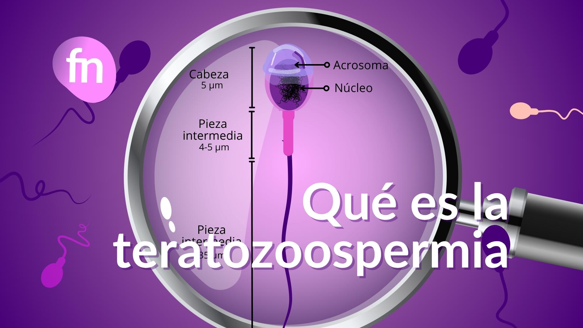 Espermatozoides vistos a través de una lupa en laboratorio para evaluar su forma y detectar teratozoospermia.