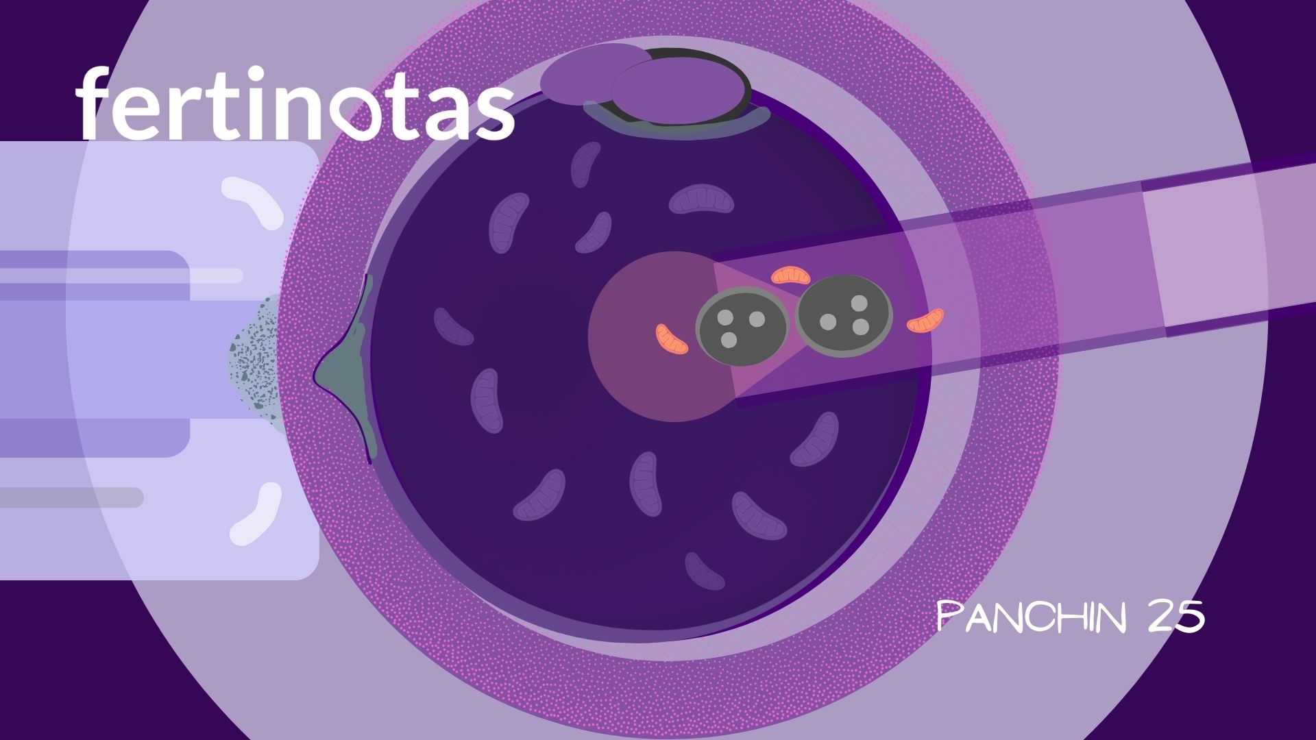 Prevención de transmisión de enfermedades mitocondriales Cigoto con transferencia de pronúcleos a óvulo donante con mitocondrias sanas, técnica para la prevención de transmisión de enfermedades mitocondriales como MELAS.