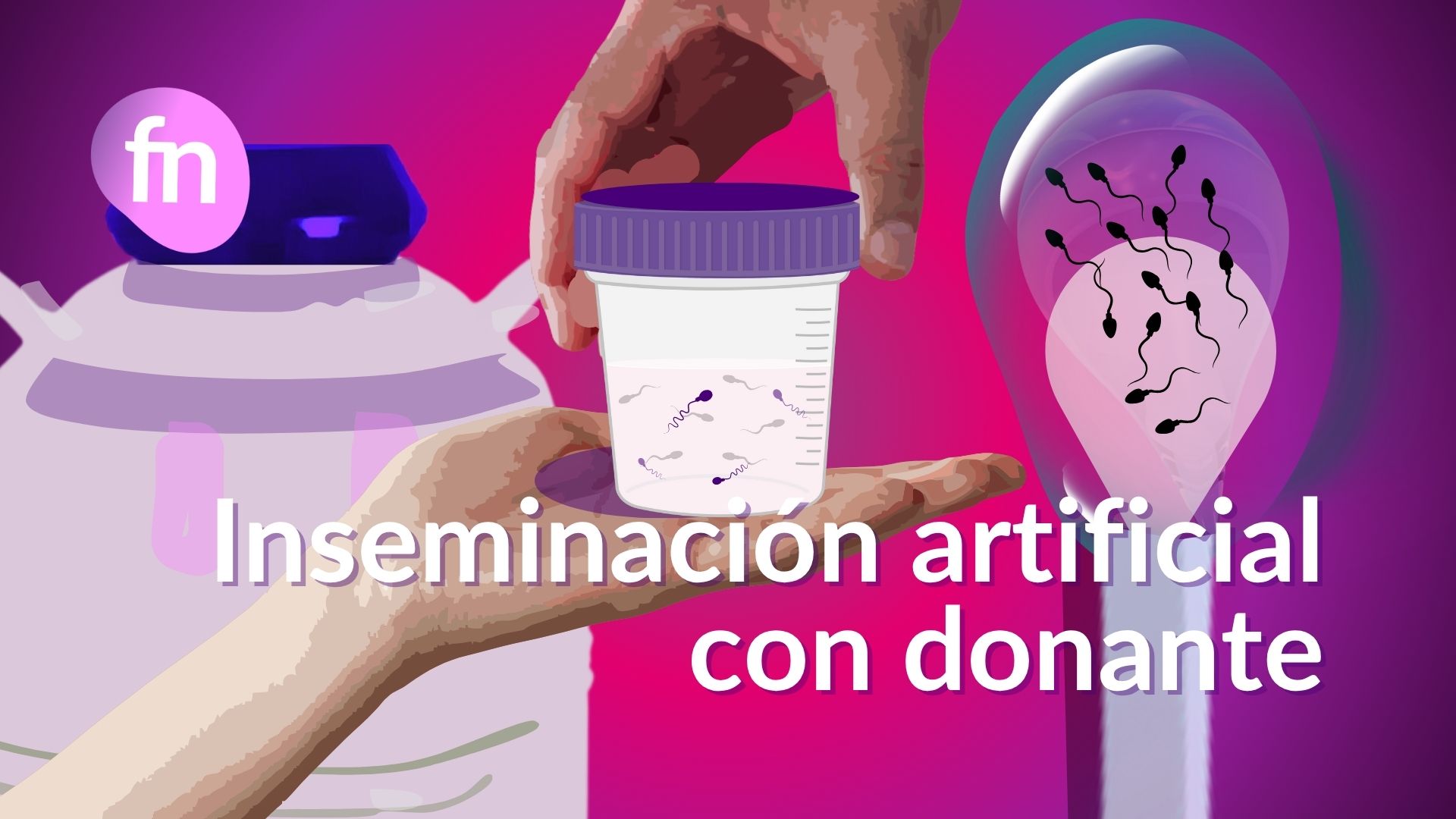 inseminación con donante, banco de semen, muestra de esperma, reproducción asistida, técnica IAD, ilustración médica, fertilidad