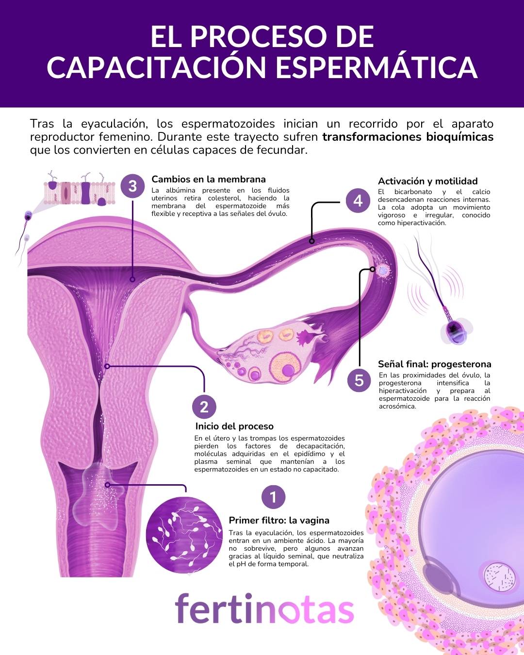 proceso de capacitacion espermática Infografía con los pasos de la capacitación espermática en el aparato reproductor femenino: pérdida de factores de decapacitación, cambios en la membrana, hiperactivación y señal final de la progesterona.