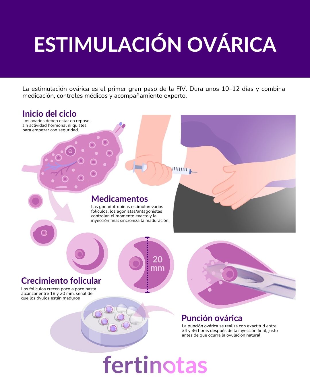 Infografía médica que explica las fases de la estimulación ovárica en fecundación in vitro: inicio, medicación, crecimiento folicular y punción ovárica