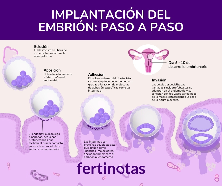Infografía médica que muestra las fases de implantación embrionaria: eclosión, aposición, adhesión e invasión en el endometrio.