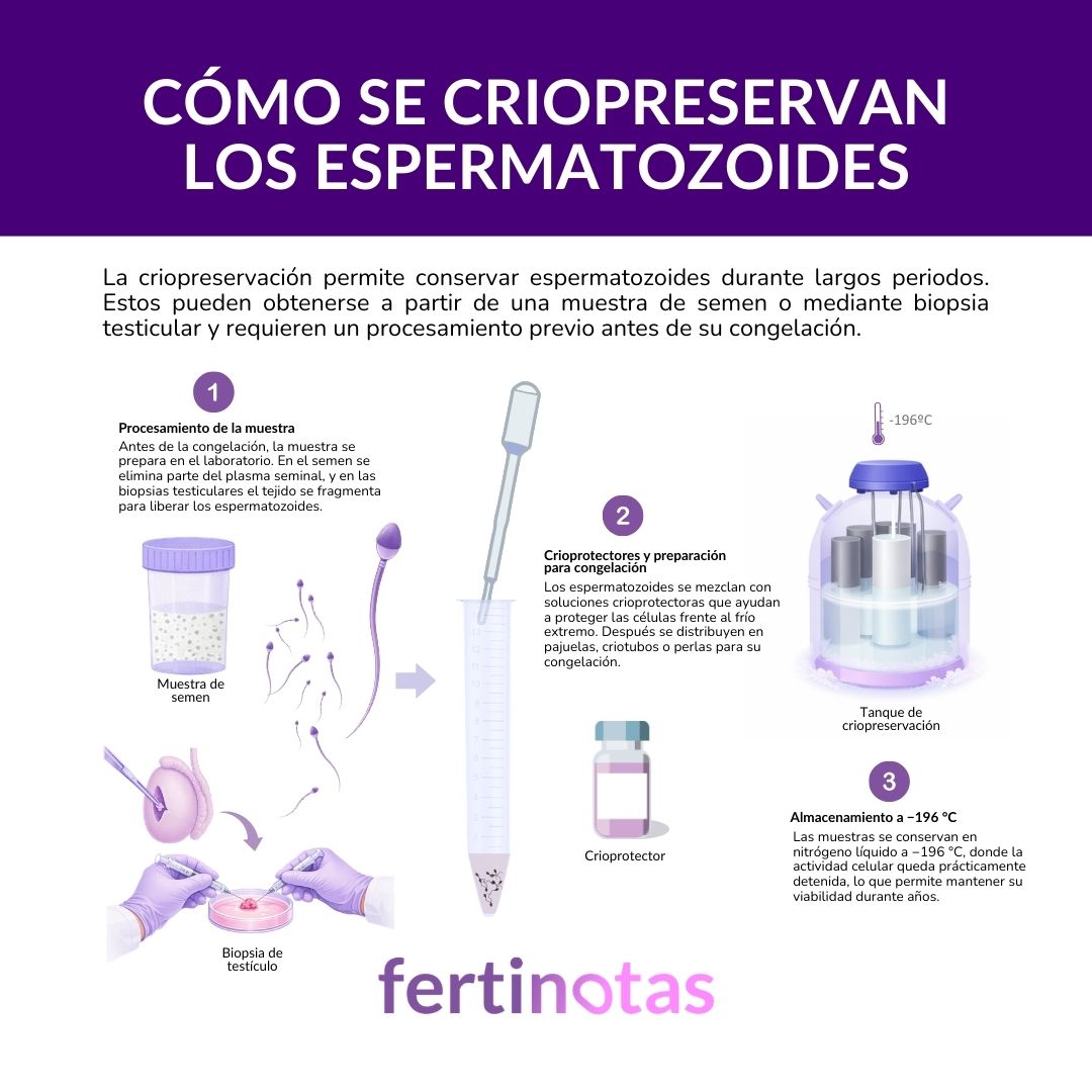 Infografía que explica cómo se congelan los espermatozoides para preservar la fertilidad masculina
