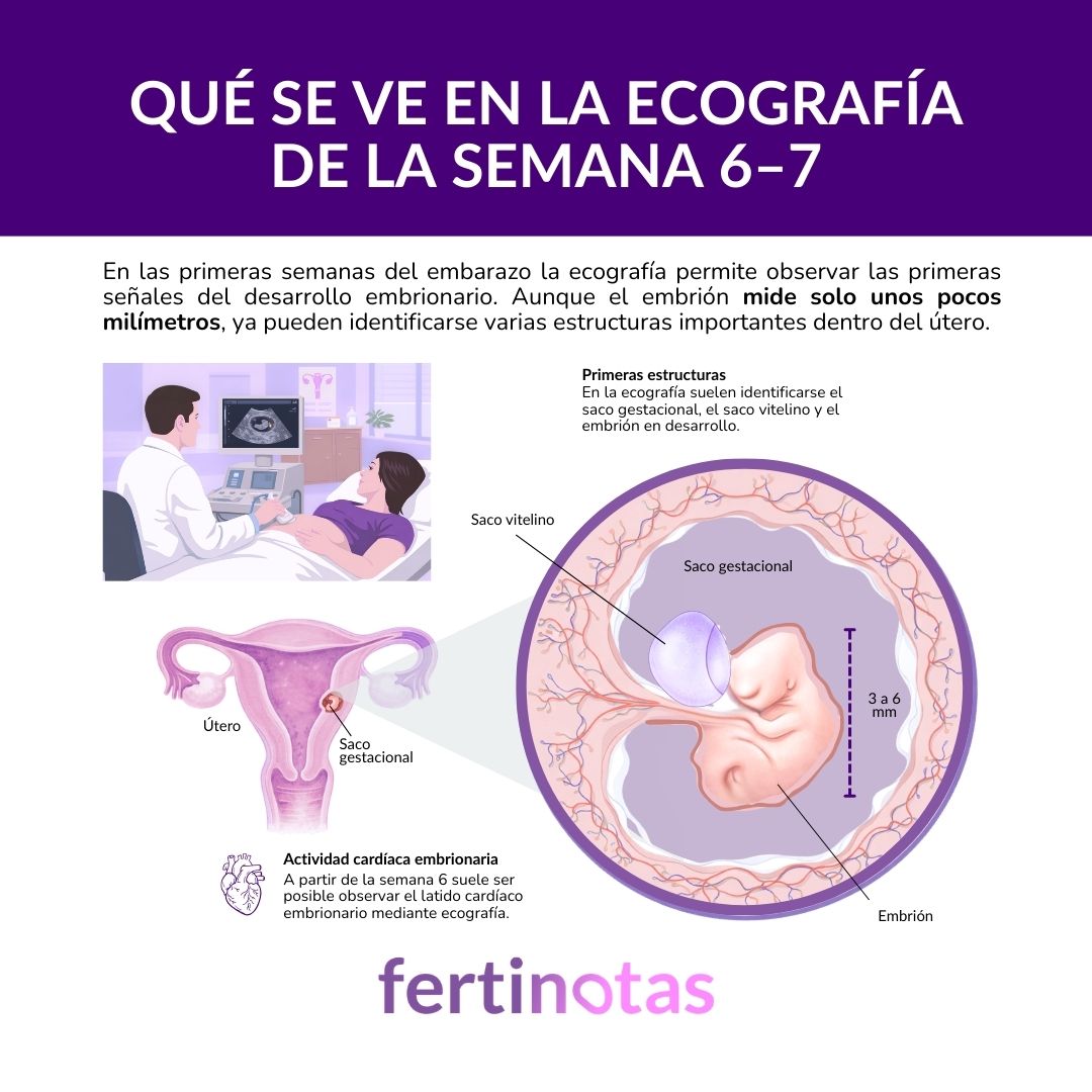 Ecografía del embarazo en semana 6 o 7 mostrando saco gestacional, saco vitelino y embrión en desarrollo