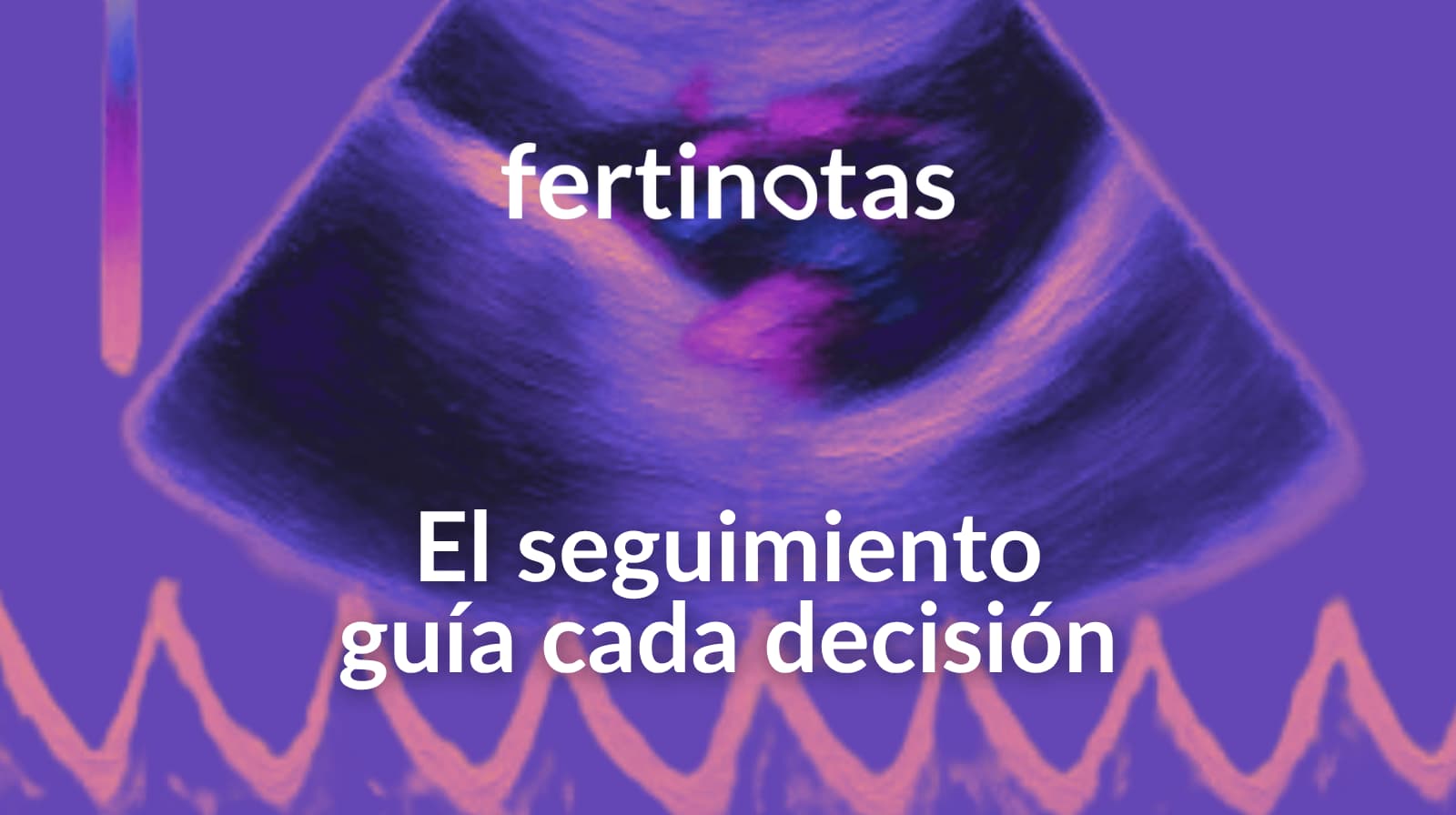 Ecografía Doppler en embarazo con percentil bajo mostrando control del bienestar fetal
