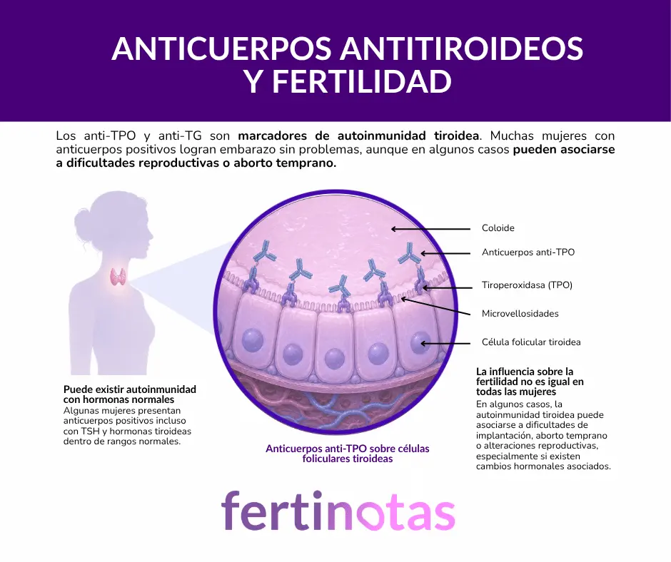Infografía médica que explica la relación entre anticuerpos antitiroideos, autoinmunidad tiroidea y fertilidad femenina.