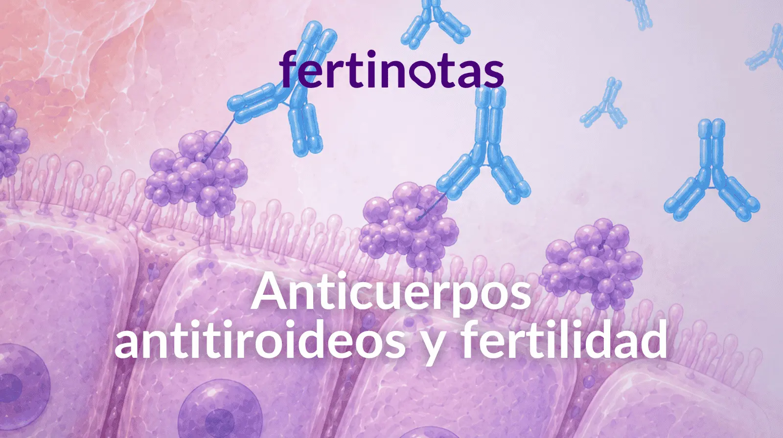 Ilustración médica de anticuerpos anti-TPO unidos a células foliculares tiroideas en un folículo tiroideo.