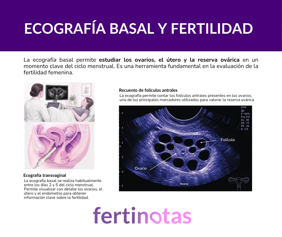 ecografía basal y evaluación de la fertilidad mujer Infografía sobre ecografía basal que muestra la realización de una ecografía transvaginal y el recuento de folículos antrales para valorar la reserva ovárica.