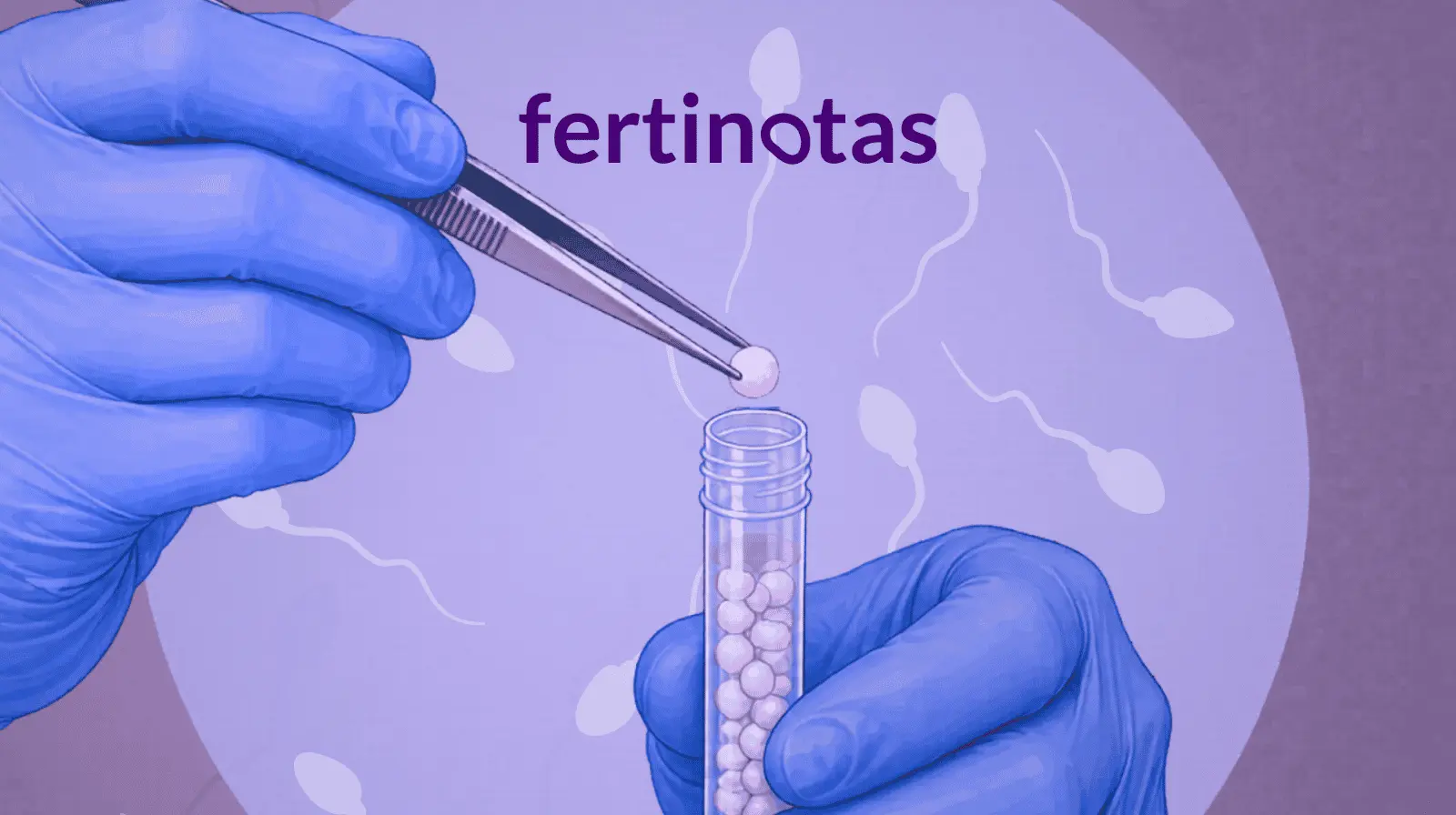 Ilustración científica de un embriólogo extrayendo una esfera congelada de espermatozoides desde un criotubo utilizando pinzas de laboratorio.