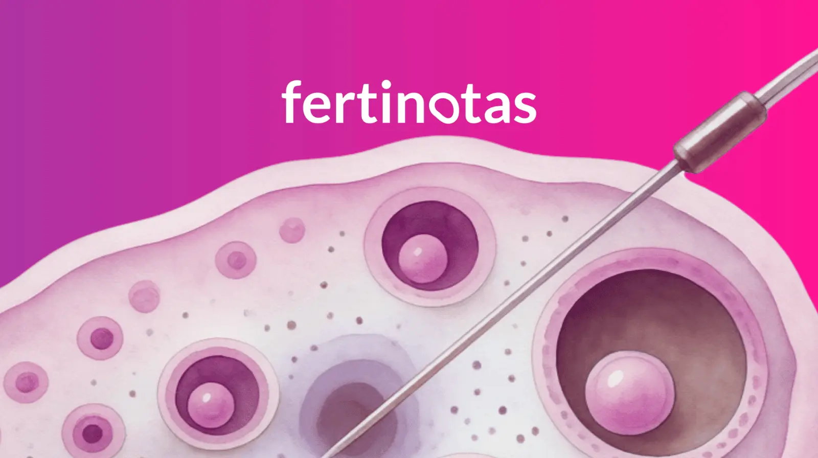 Ilustración de un ovario con folículos y una sonda de microdiálisis que representa el estudio local de la AMH dentro del tejido ovárico.