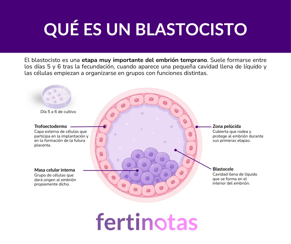 Infografía de un blastocisto humano con sus partes principales: trofoectodermo, masa celular interna, blastocele y zona pelúcida.