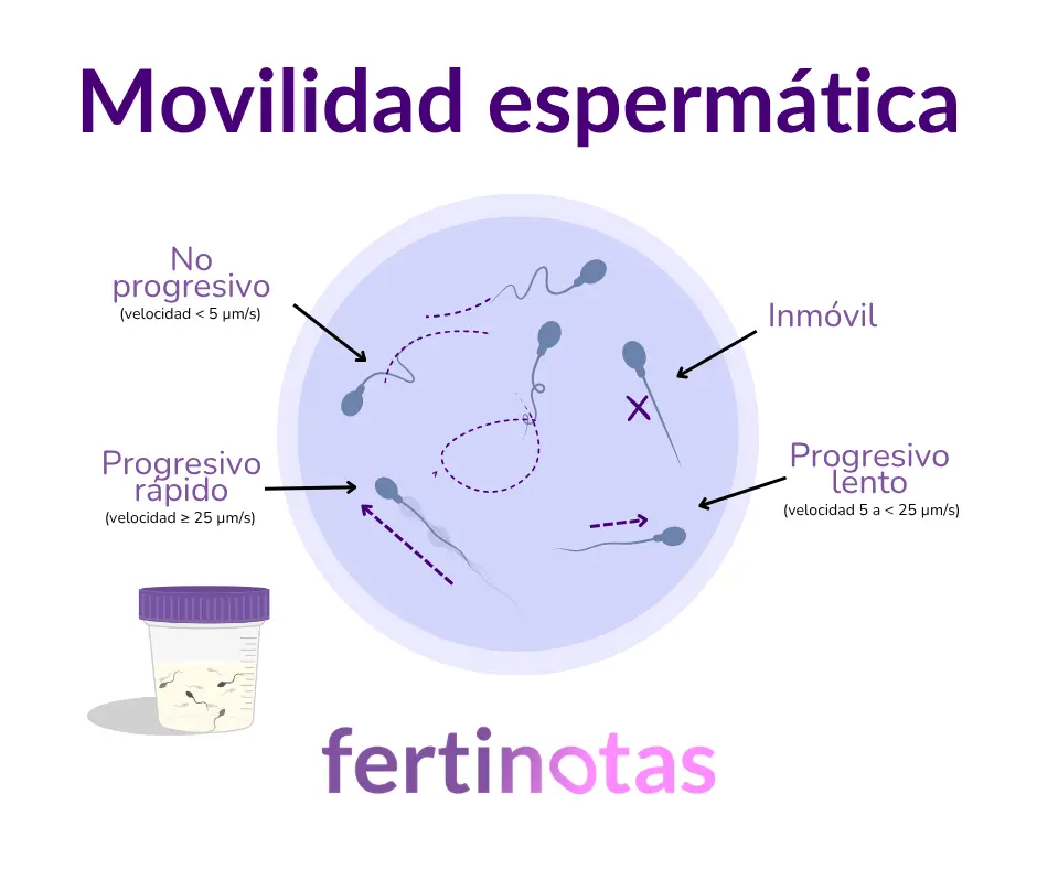 Infografía médica sobre la movilidad espermática en el seminograma, con espermatozoides progresivos, no progresivos e inmóviles.