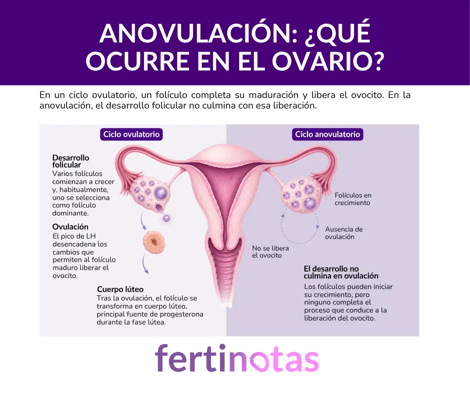 anovulacion que ocurre en el ovario Infografía sobre anovulación que compara un ciclo ovulatorio con un ciclo anovulatorio y muestra el desarrollo folicular, la ovulación y el cuerpo lúteo.