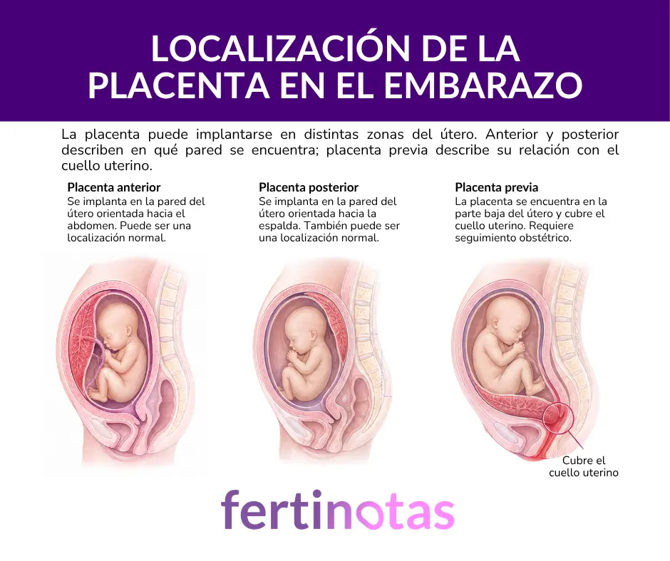 Comparación de placenta anterior, placenta posterior y placenta previa según su localización en el útero.