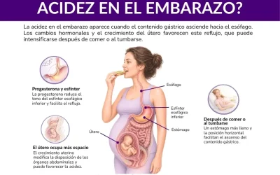 Acidez en el embarazo: causas y cómo aliviarla