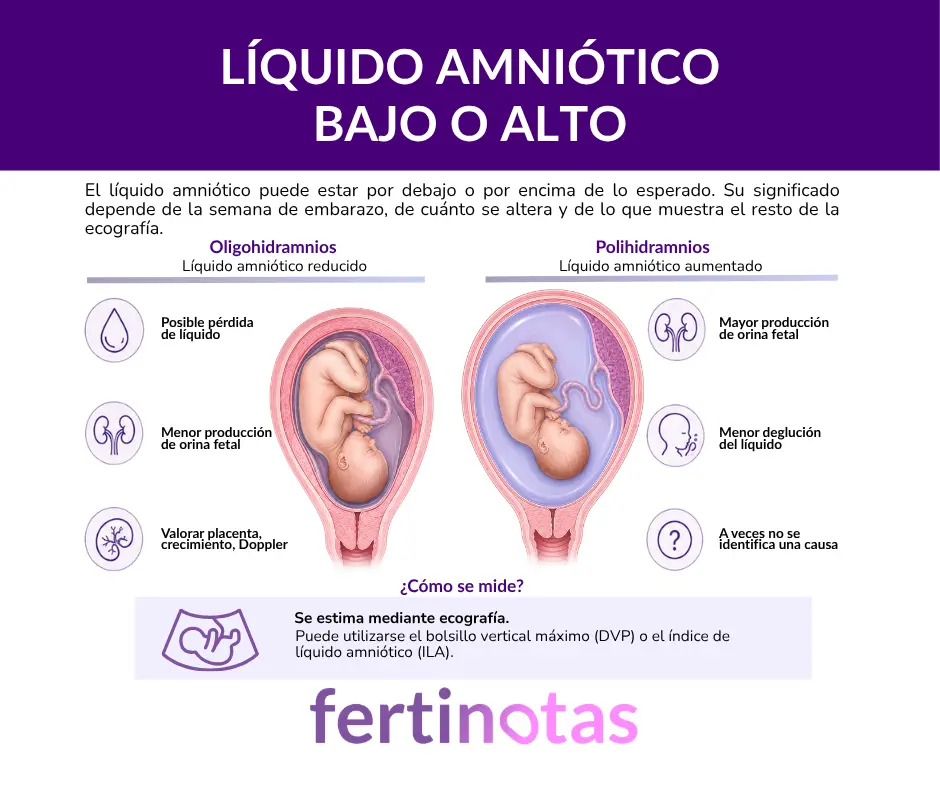 que es tener poco o mucho liquido amniotico en el embarazo e importancia Infografía sobre líquido amniótico bajo y alto durante el embarazo, con oligohidramnios y polihidramnios.