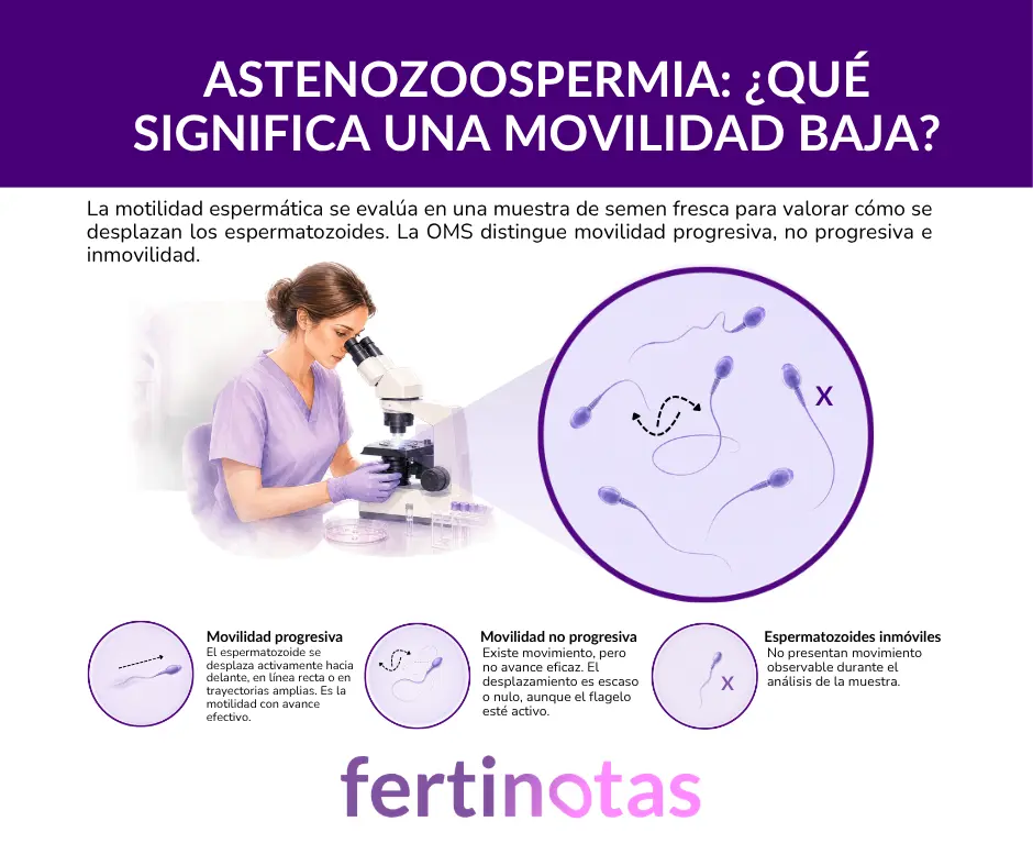 Infografía que explica la movilidad progresiva, no progresiva e inmovilidad de los espermatozoides en la astenozoospermia.