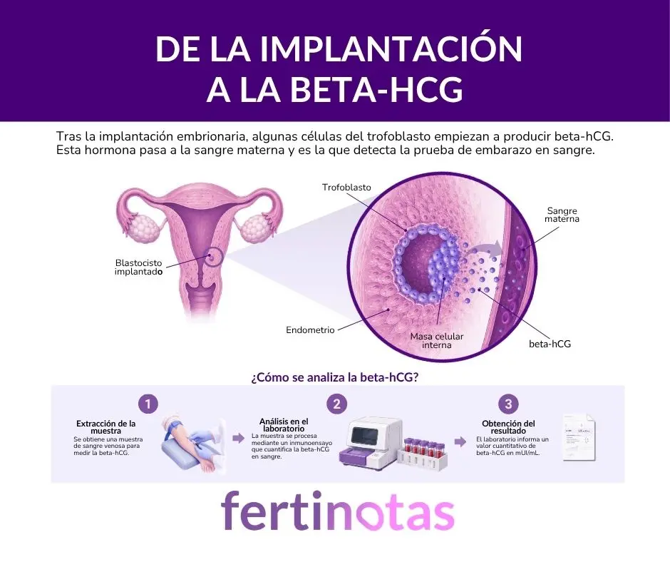 Infografía sobre cómo la implantación embrionaria produce beta-hCG y cómo se analiza esta hormona en sangre durante la betaespera tras una FIV.