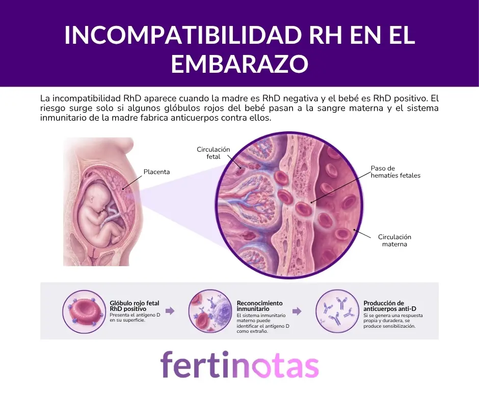 que es la incompatibilidad rh Infografía médica que explica la incompatibilidad Rh en el embarazo, el paso de glóbulos rojos fetales a la circulación materna y la formación de anticuerpos anti-D