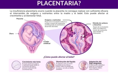 Insuficiencia placentaria: qué es y cómo se vigila