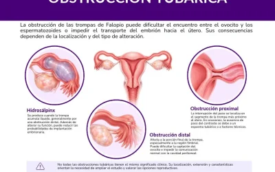 Trompas de Falopio obstruidas: embarazo y tratamientos